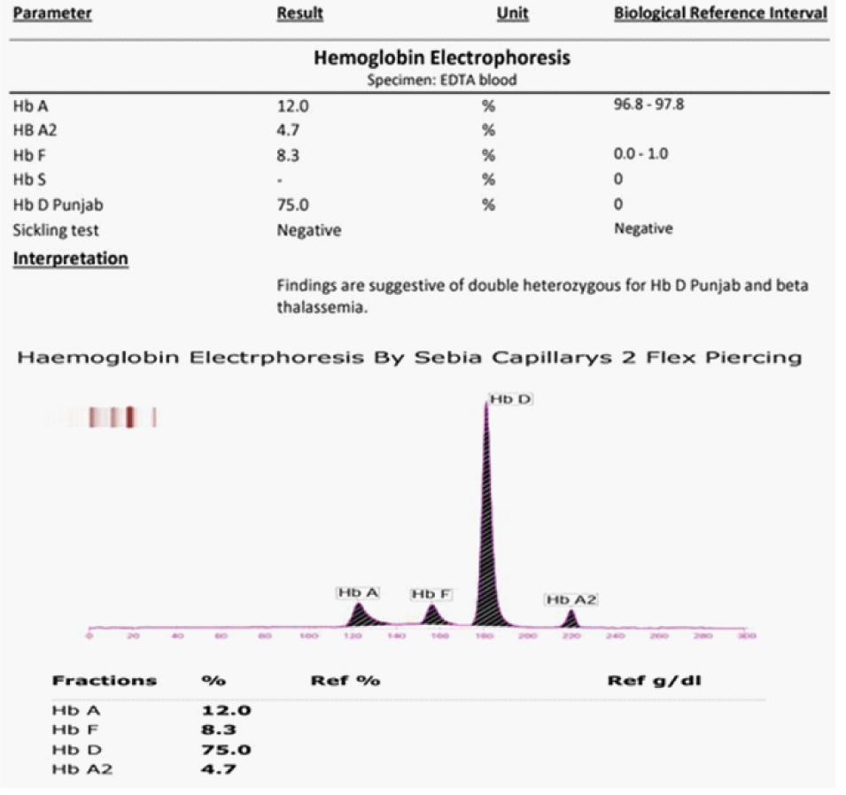 hb-electrophoresis-test-1s-pharma-xonline