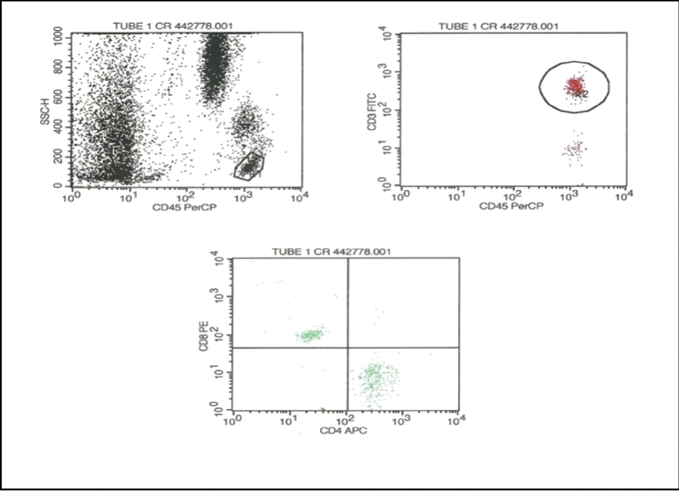 Flow cytometric analysis of IL-17 (Th17). Initially, the CD4 lymphocyte ...