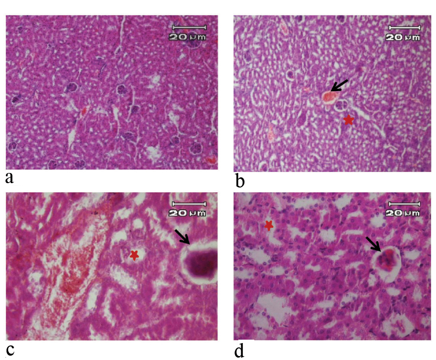 Toxic Responses of Kidney