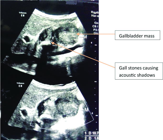 [Table/Fig-2]: