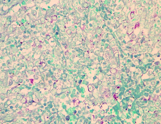 [Table/Fig-5a]: