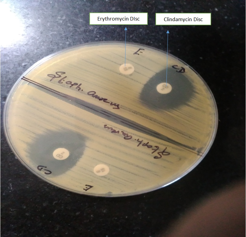 [Table/Fig-5]: