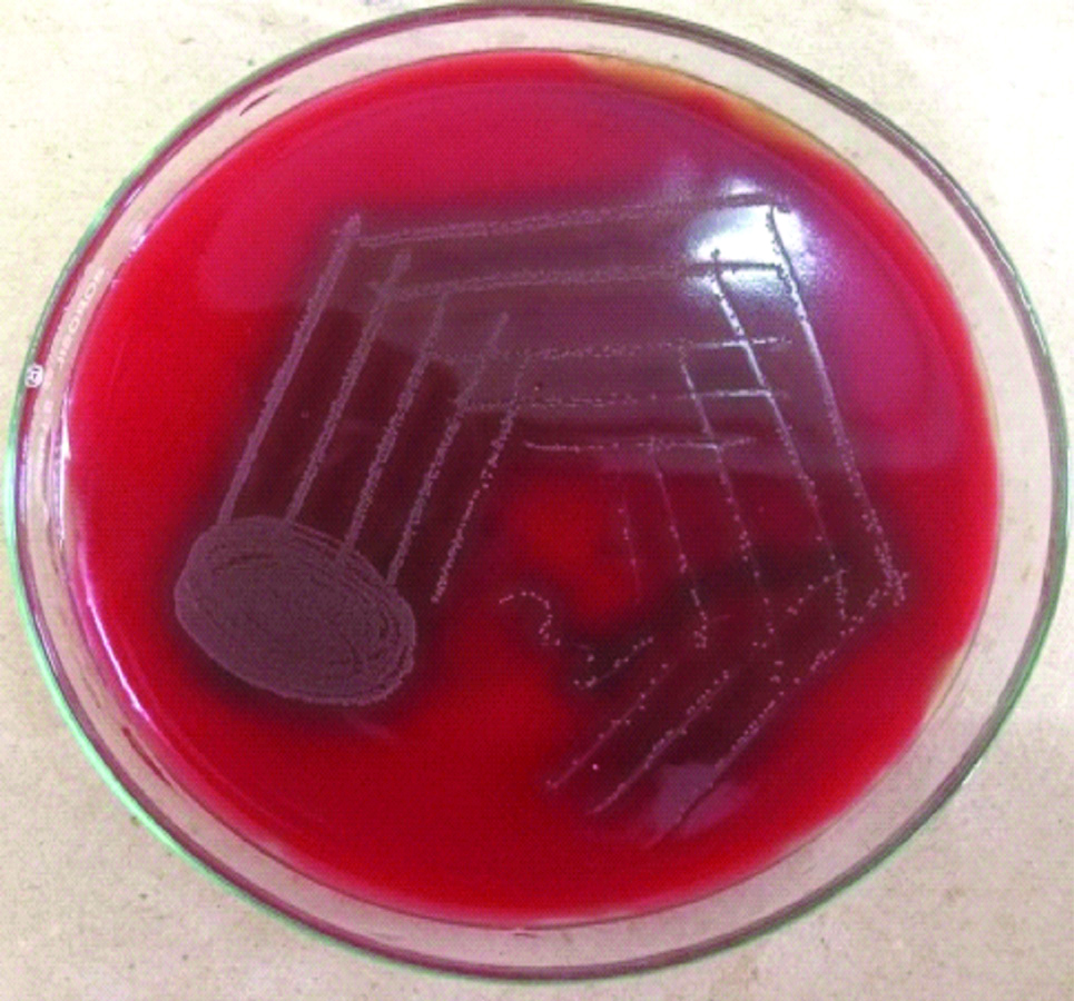 Enterococcus Faecalis Macconkey Agar