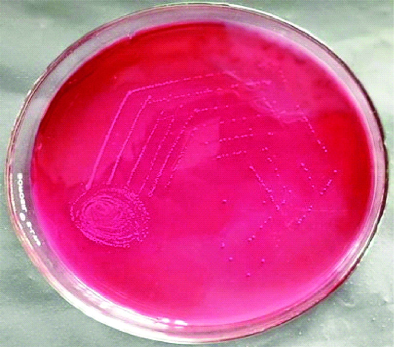 Enterococcus Faecalis Macconkey Agar