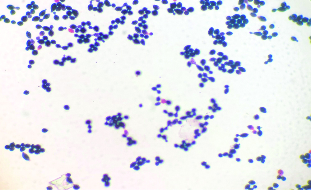 correcto Ropa Posada candida albicans gram stain Alacena travesura ...