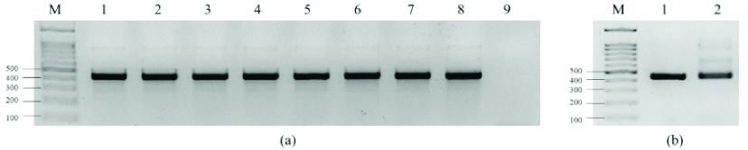 Bioinformatic Analysis of the Amplified PCR Product from Patient