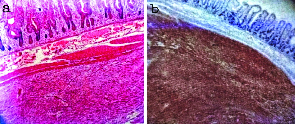 Gist Microscope Article Fulle Text