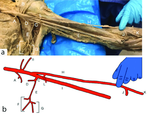 thoracoacromial artery cadaver