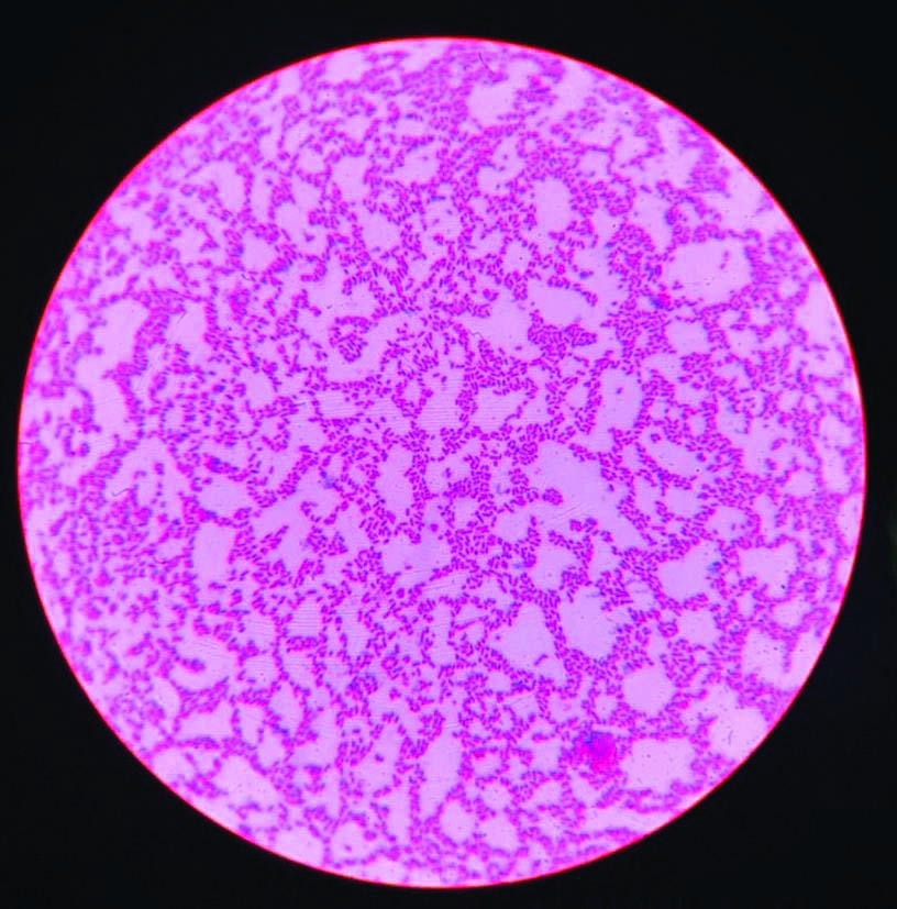 Proteus Vulgaris Gram Stain Proteus Vulgaris Gram Stain 