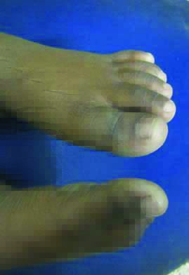 [Table/Fig-3]: