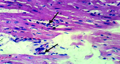 Histopathology of heart of rat from control (+) showing intermuscular ...