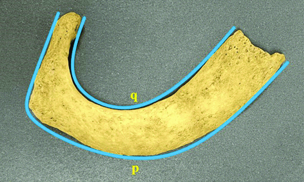 a- Shortest internal length of the first rib, b- Shortest external ...