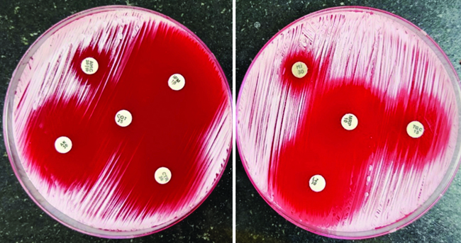 Antibiotic susceptibility testing by disc diffusion method.