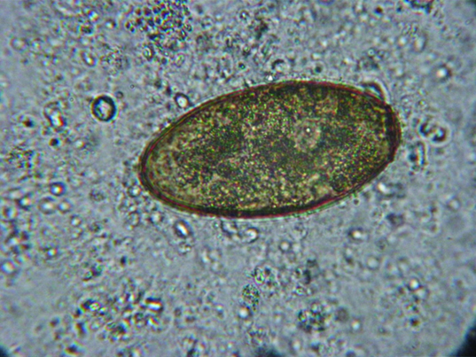 Paragonimus Westermani Egg