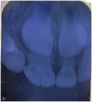 [Table/Fig-5]: