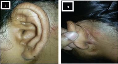 [Table/Fig-2a,b]: