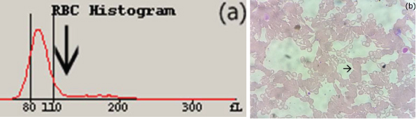 All samples were analysed on Beckman Coulter LH780 (Coulter, India) and ...