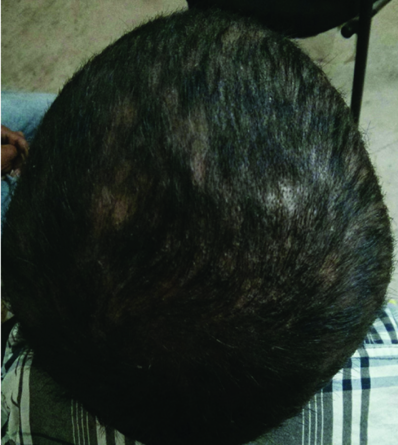 [Table/Fig-3]: