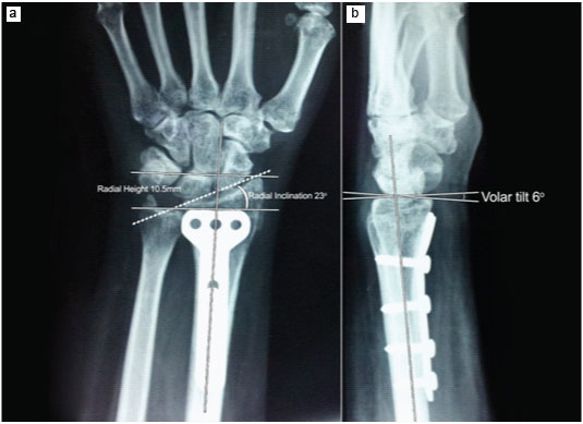 Radiological parameters.