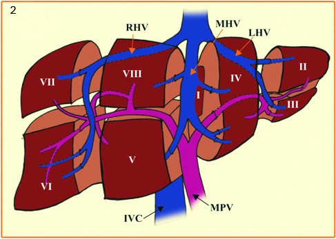 RHV - Right hepatic vein; LHV - Left hepatic vein; MHV - Middle hepatic ...