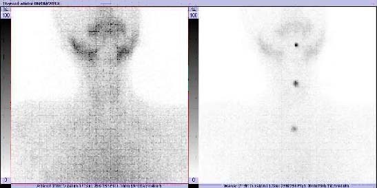 [Table/Fig-3a,b]: