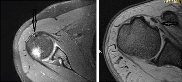Demonstrating the result of various clinical and radiological ...
